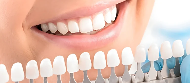 Cosmetic Dentistry Solutions at Kensington Dental