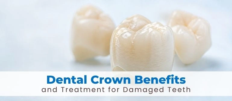 Dental Crown Benefits and Treatment for Damaged Teeth