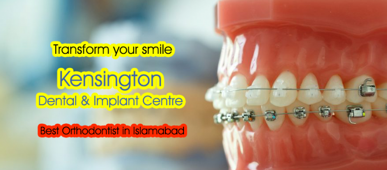 Best Orthodontist in Islamabad