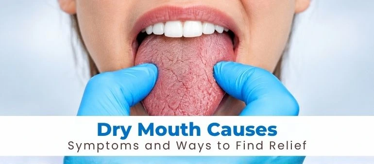 Dry Mouth Causes Symptoms and Ways to Find Relief
