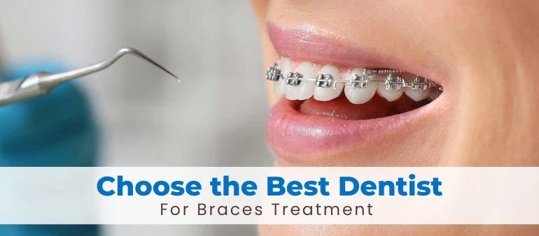How to Choose the Best Dentist for Braces Treatment Guide