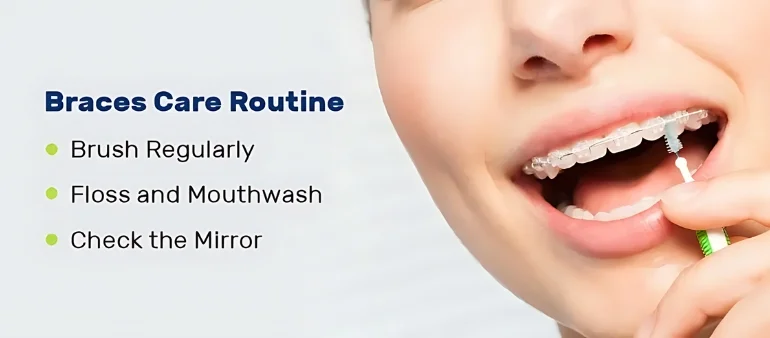 Maintain a Healthy Smile While Wearing Braces