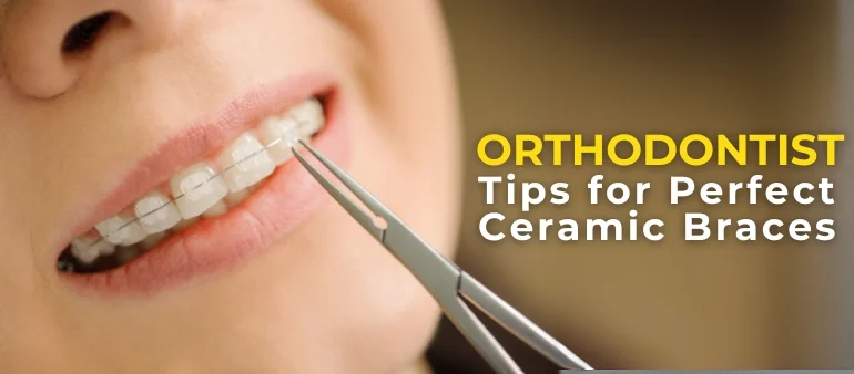 Orthodontist Tips for Perfect Ceramic Braces