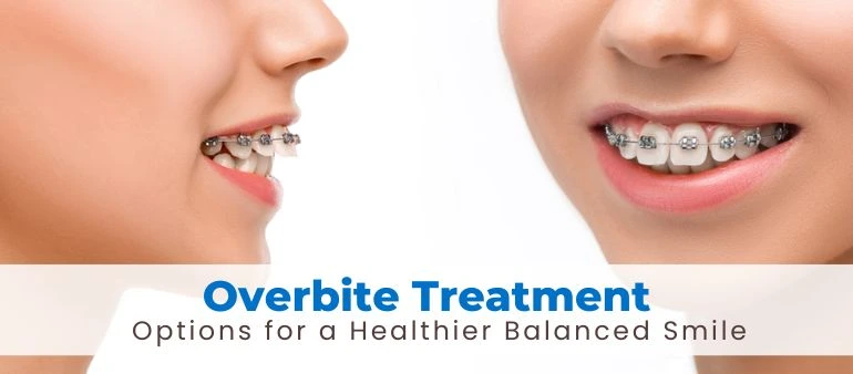 Overbite Treatment Options for a Healthier Balanced Smile