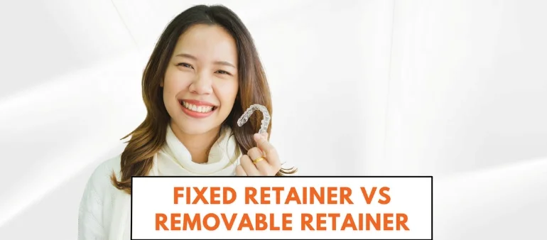 Removable vs Fixed Retainers: What's Best for You?
