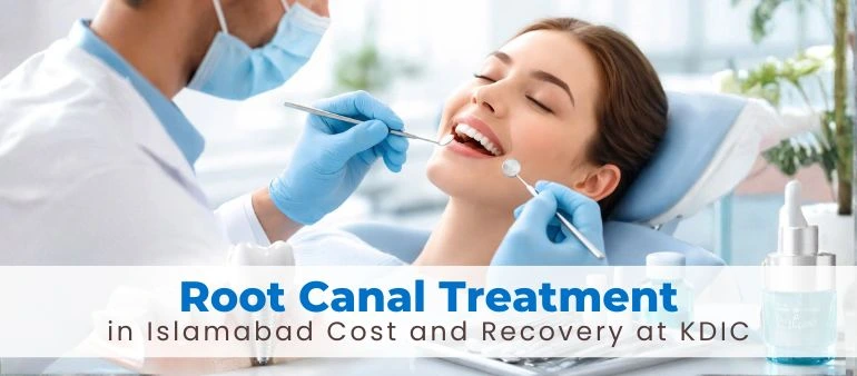 Root Canal Treatment in Islamabad Cost and Recovery at KDIC