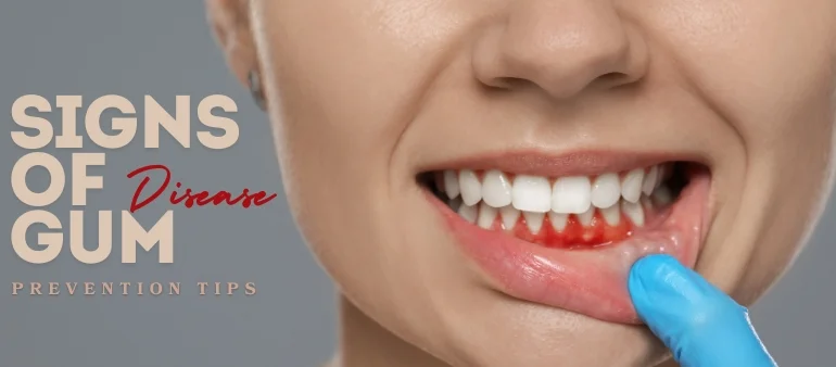 Signs of Gum Disease and How Is It Treated?