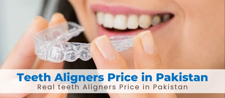 Teeth Aligners Price in Pakistan: Why ClearPath Aligners Are the Top Choice