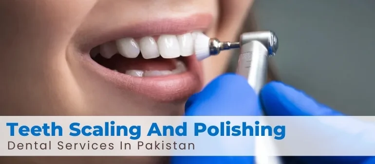 Teeth Scaling And Polishing Dental Services In Pakistan