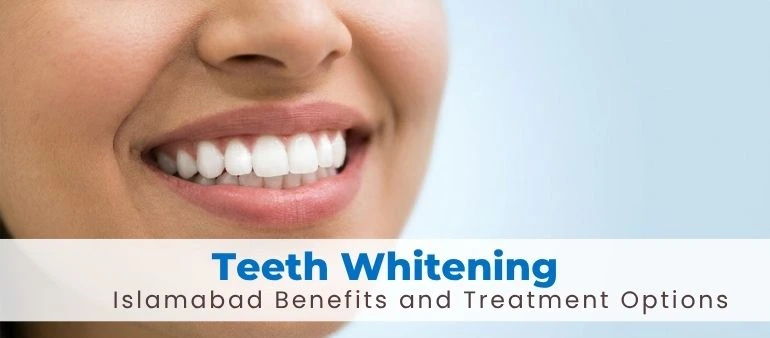 Teeth Whitening Islamabad Benefits and Treatment Options
