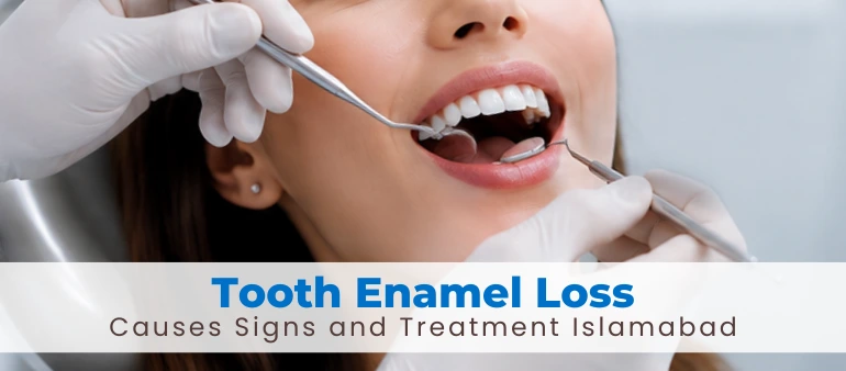 Tooth Enamel Loss Causes Signs and Treatment Islamabad