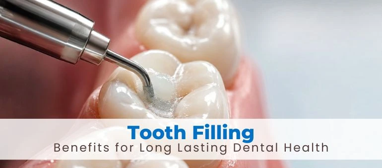 Tooth Filling Benefits for Long Lasting Dental Health