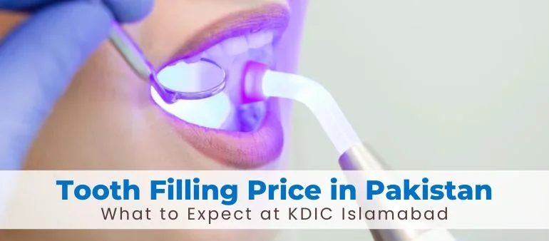 Tooth Filling Price in Pakistan: What to Expect at KDIC Islamabad