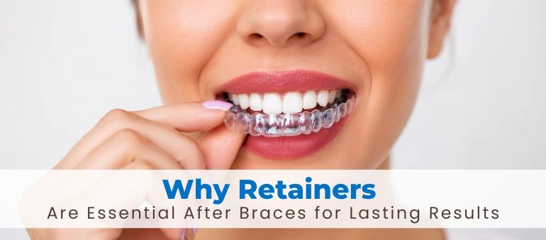 Why Retainers Are Essential After Braces for Lasting Results
