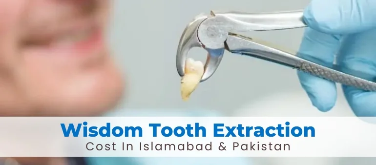 Wisdom Tooth Extraction Cost In Islamabad & Pakistan