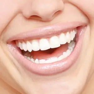 Tooth Whitening